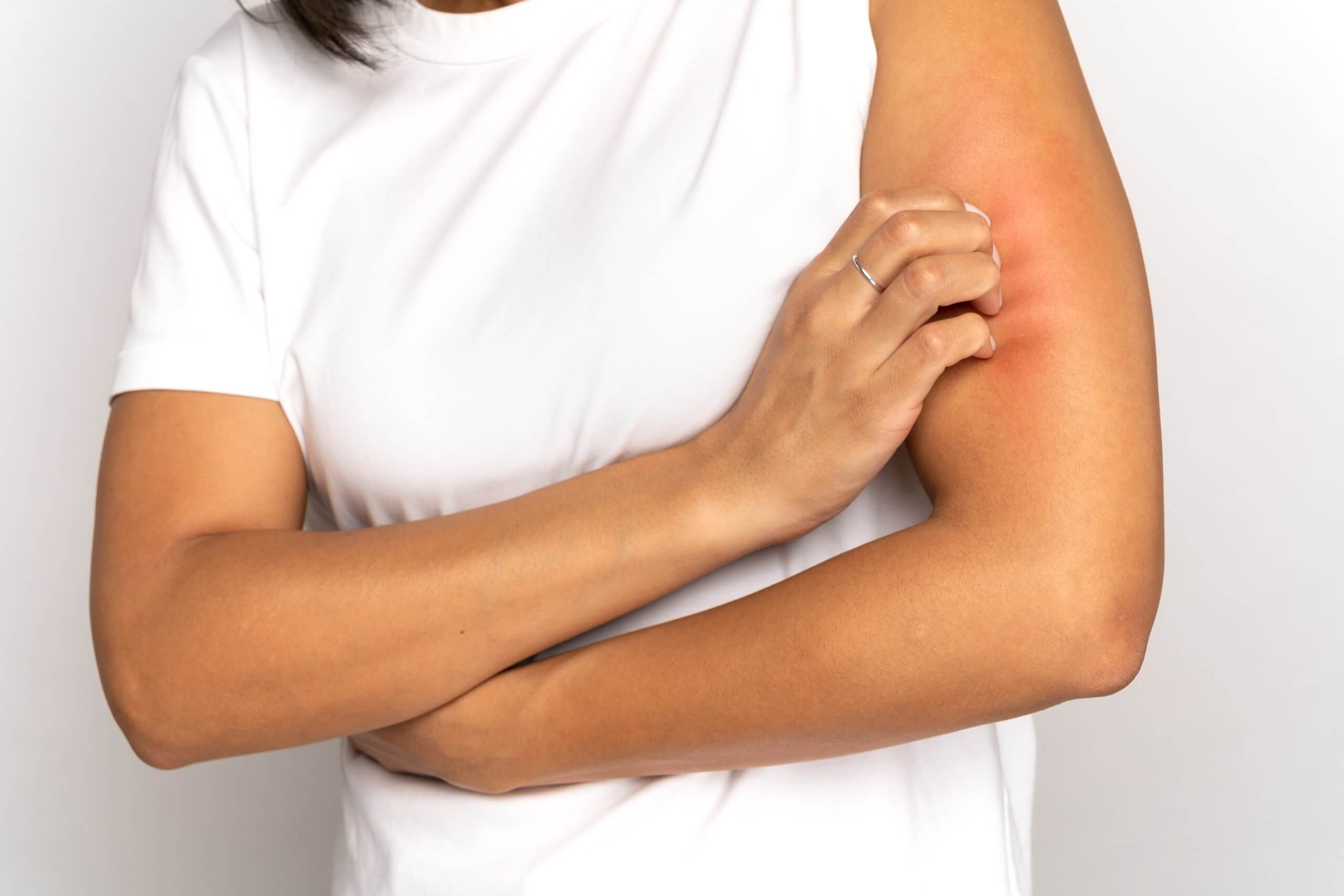 Learn what causes menopause skin rash, common symptoms, treatment options, skincare tips, and when to see a doctor. Expert-backed guide for healthier skin.
