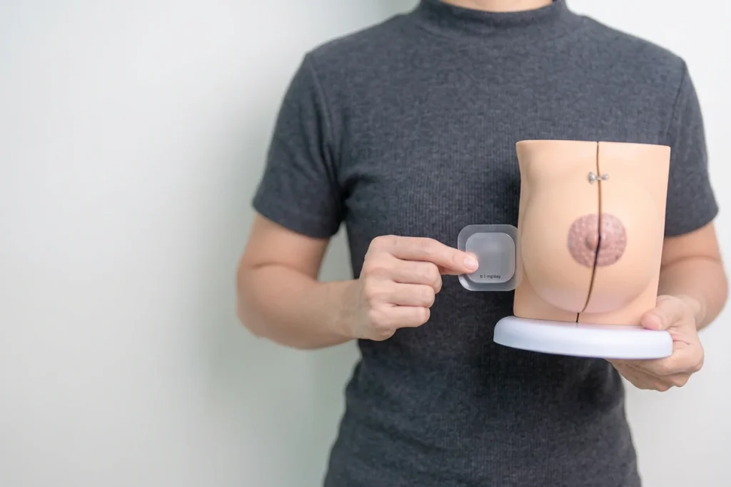 Estrogen patch and breast cancer risk: transdermal estrogen patch used for menopause HRT.