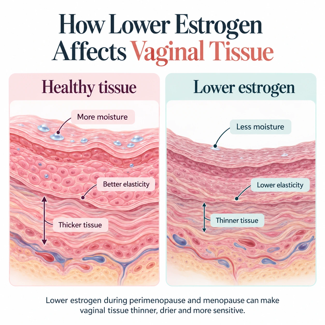 Medical illustration showing healthy vaginal tissue compared with drier, thinner tissue after lower estrogen
